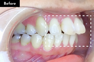 Case 01 Before
